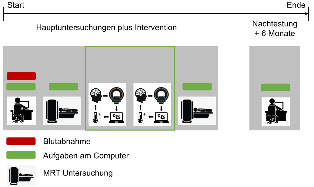 Kann Neurofeedback das Gedächtnis stärken?